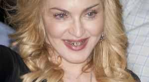 Madonna_Goldzähne